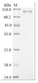 SDS-PAGE (WRN-1387H).jpg